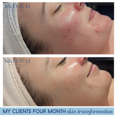 Face Reality Treatment Package