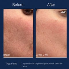 Vivid Brightening Serum