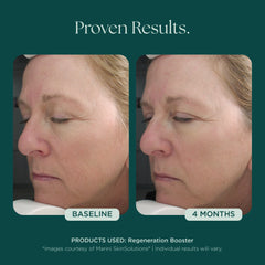 Regeneration Booster | Free Shipping